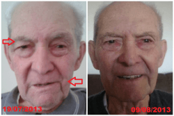 Fisioterapia Facial